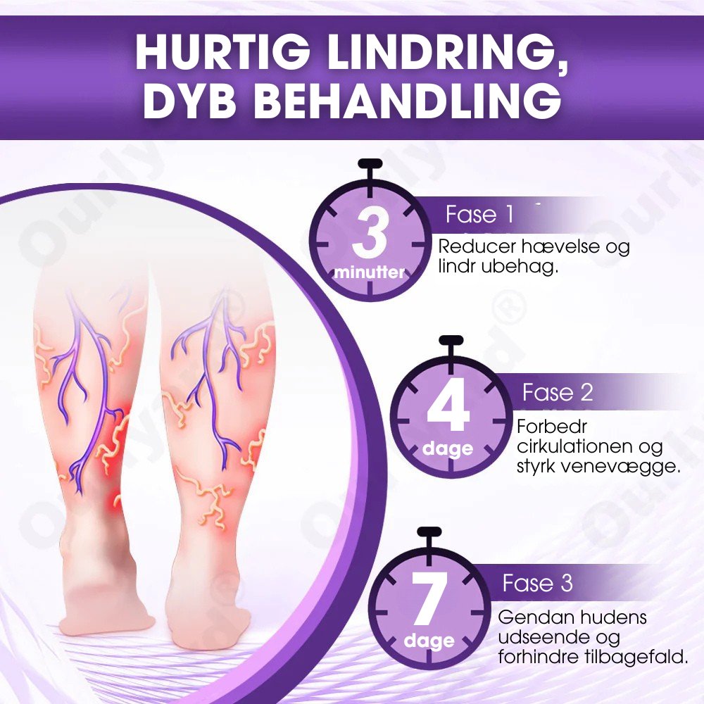 DiaLeg Care™ – Phyto-creme mod åreknuder, hævelse og bensmerter