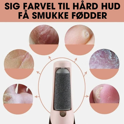 CalluCare™ - Elektrisk eeltfjerner