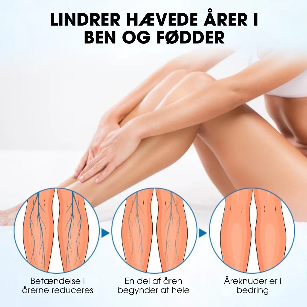 Timilk® VeinGuard – Klinisk bevist til at reducere åreknuder