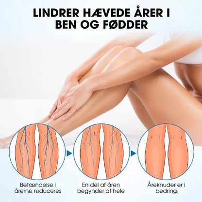 Timilk® VeinGuard – Klinisk bevist til at reducere åreknuder