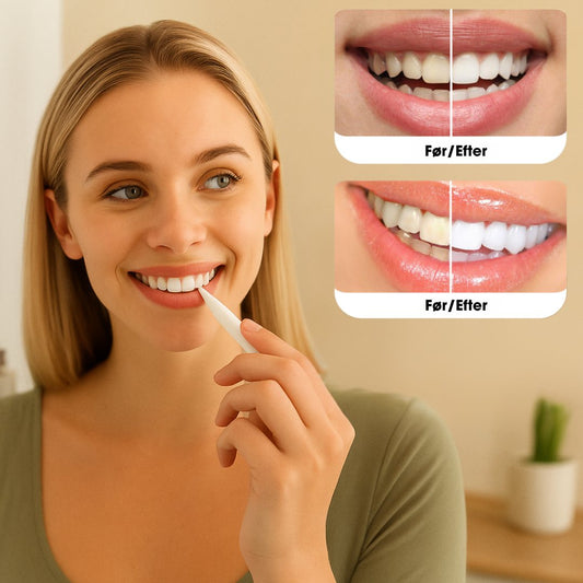 BrightSmile™ – Klinik-inspireret tandblegning til hjemmebrug