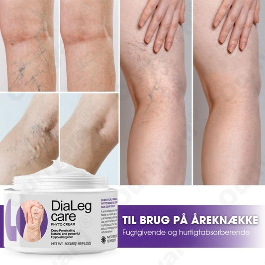DiaLeg Care™ – Phyto-creme mod åreknuder, hævelse og bensmerter