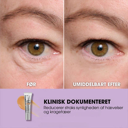EyeRevive™ – Øjeblikkelig øjenopstrammer + GRATIS børste