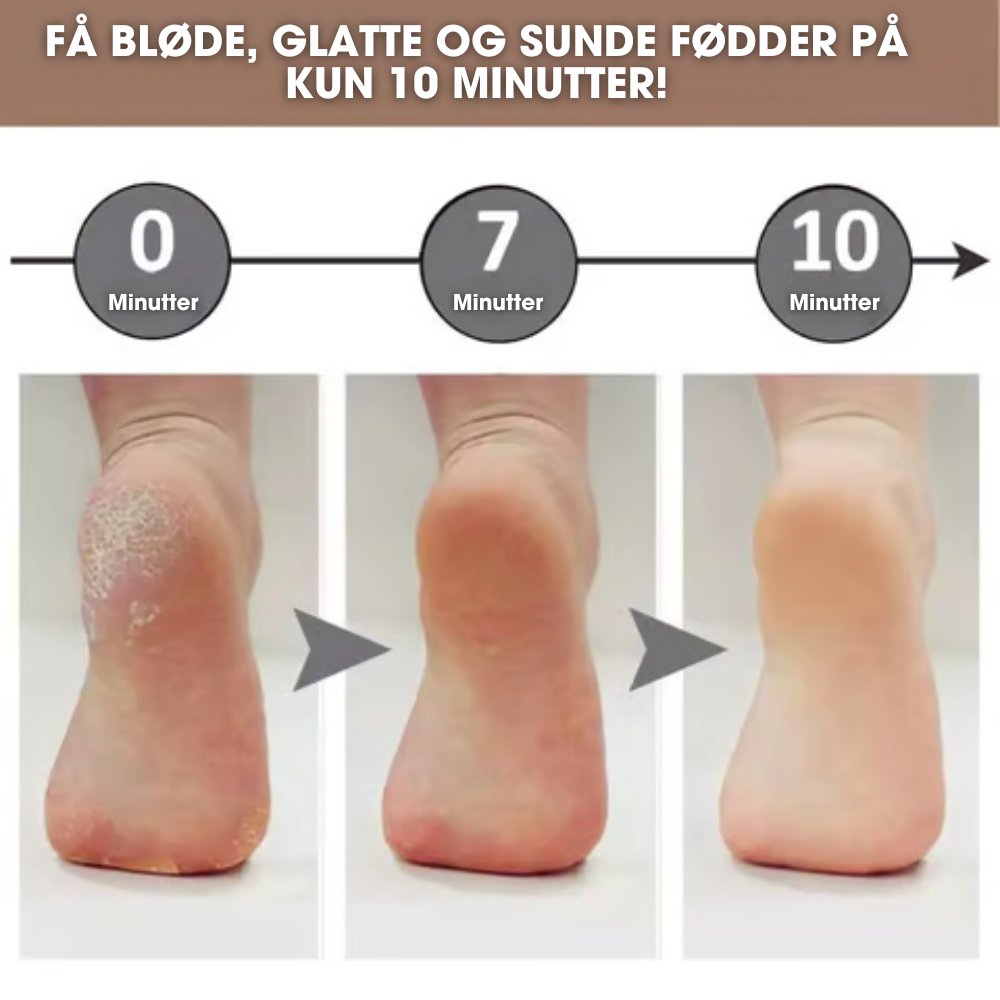 CalluCare™ - Elektrisk eeltfjerner