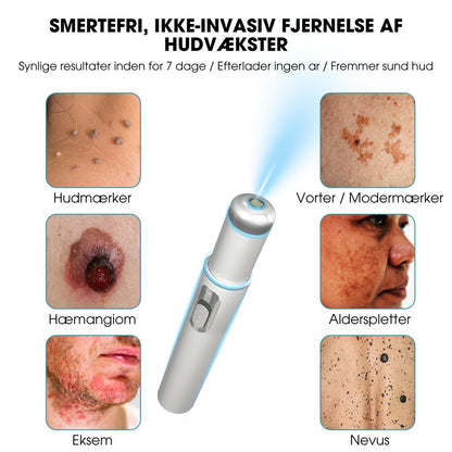 DermaLight Pro™ - Ikke-invasiv laserpen til modermærker, vorter og hudflapper