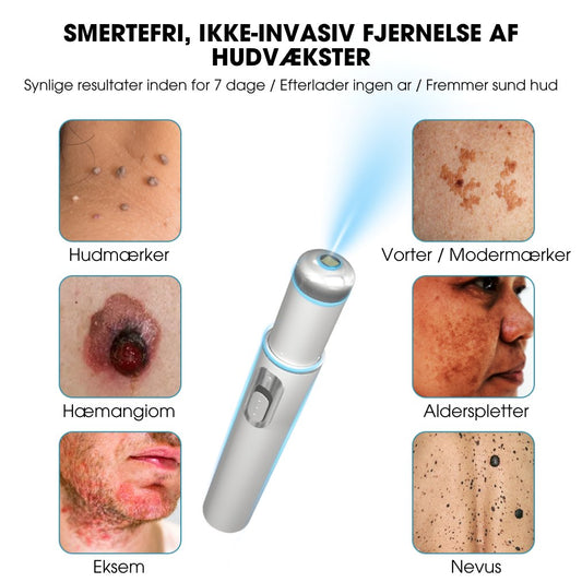 DermaLight Pro™ - Ikke-invasiv laserpen til modermærker, vorter og hudflapper