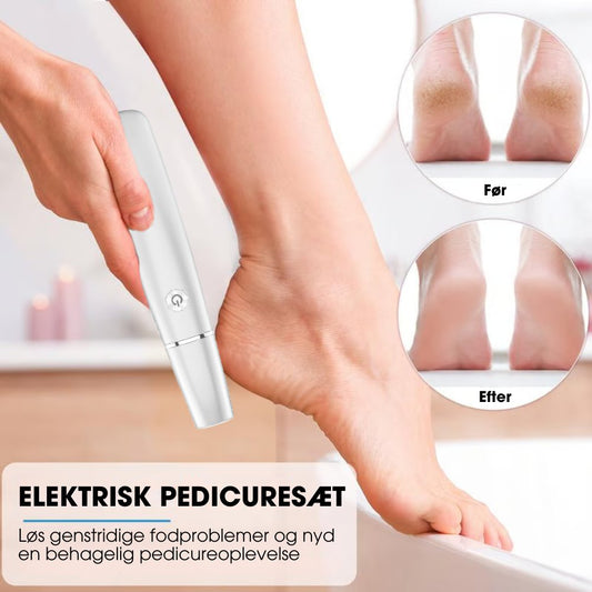 CalluCare™ - Elektrisk eeltfjerner