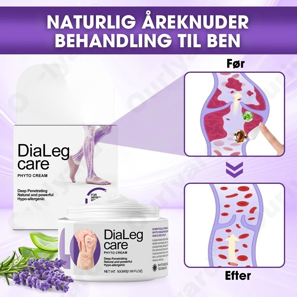 DiaLeg Care™ – Phyto-creme mod åreknuder, hævelse og bensmerter